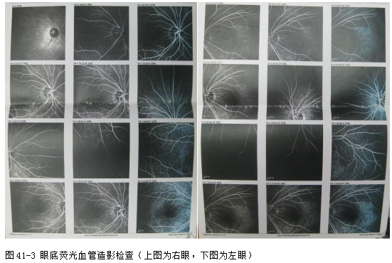 ZY016_225_2.gif